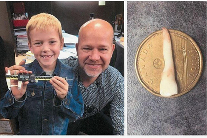 Мальчик вырастил самый длинный зуб и попал в Книгу рекордов Гиннесса